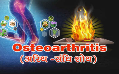 अस्थि-संधि शोथ